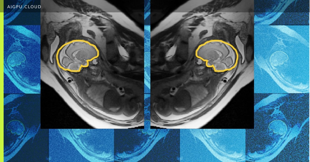 MRI scan of a fetal brain outlined in yellow, showing sagittal view with E(3)-Pose motion tracking overlay